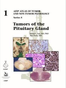 Tumors of the Pituitary Gland - Click Image to Close