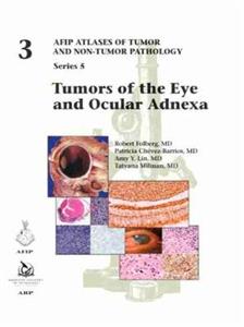 Tumors of the Eye and Ocular Adnexa - Click Image to Close