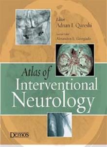 Atlas of Interventional Neurology