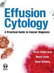 Effusion Cytology
