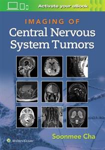 Imaging of CNS Tumors - Click Image to Close