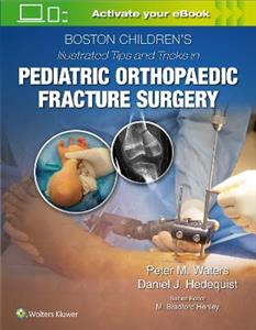 Boston Children?s Illustrated Tips and Tricks in Pediatric Orthopaedic Fracture Surgery - Click Image to Close