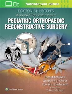 Boston Children's Illustrated Tips and Tricks in Pediatric Orthopaedic Reconstructive Surgery - Click Image to Close