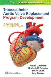 Transcatheter Aortic Valve Replacement Program Development - Click Image to Close