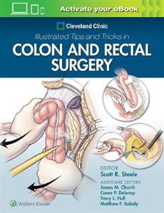 Cleveland Clinic Illustrated Tips and Tricks in Colon and Rectal Surgery - Click Image to Close