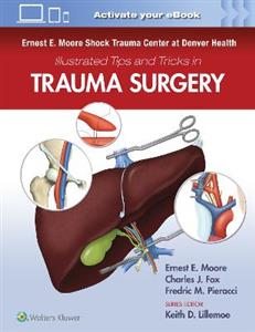 Ernest E. Moore Shock Trauma Center at Denver Health Illustrated Tips and Tricks in Trauma Surgery - Click Image to Close