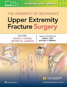 The University of Michigan's Upper Extremity Fracture Surgery - Click Image to Close