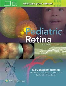 Pediatric Retina - Click Image to Close