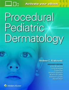 Procedural Pediatric Dermatology - Click Image to Close