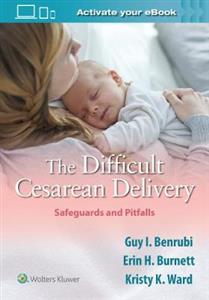 Difficult Cesarean Delivery: Safeguards and Pitfalls - Click Image to Close