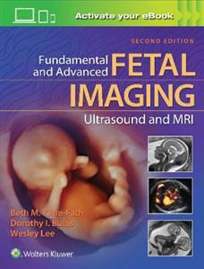 Fundamental and Advanced Fetal Imaging Ultrasound and MRI - Click Image to Close