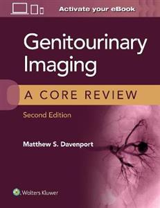Genitourinary Imaging: A Core Review - Click Image to Close
