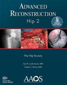 Advanced Reconstruction: Hip 2: Print + Ebook with Multimedia (AAOS - American Academy of Orthopaedic Surgeons) - Click Image to Close