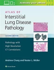 Atlas of Interstitial Lung Disease Pathology - Click Image to Close
