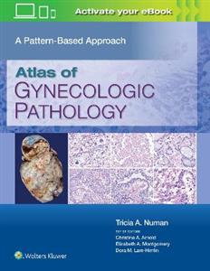 Atlas of Gynecologic Pathology: A Pattern Based Approach