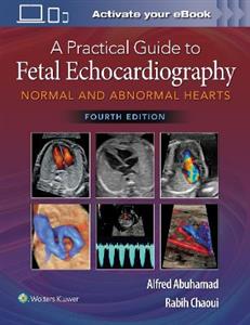 A Practical Guide to Fetal Echocardiography: Normal and Abnormal Hearts - Click Image to Close