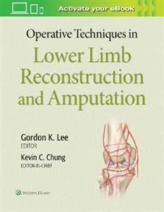 Operative Techniques in Lower Limb Reconstruction and Amputation - Click Image to Close