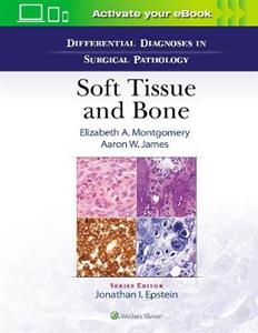 Differential Diagnoses in Surgical Pathology: Soft Tissue and Bone - Click Image to Close
