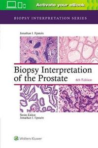 Biopsy Interpretation of the Prostate (Biopsy Interpretation Series) - Click Image to Close