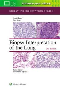 Biopsy Interpretation of the Lung - Click Image to Close