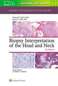 Biopsy Interpretation of the Head and Neck - Click Image to Close