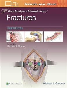 Master Techniques in Orthopaedic Surgery: Fractures - Click Image to Close