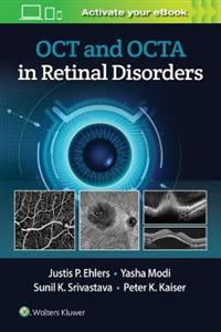 OCT and OCT Angiography in Retinal Disorders - Click Image to Close