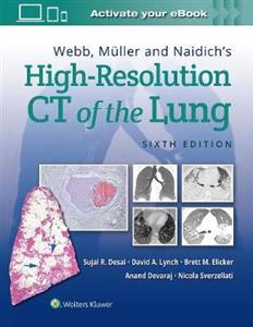 Webb, Muller and Naidich's High-Resolution CT of the Lung - Click Image to Close