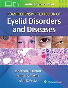 Comprehensive Textbook of Eyelid Disorders and Diseases - Click Image to Close