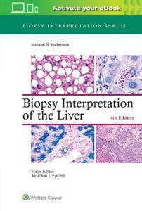 Biopsy Interpretation of the Liver - Click Image to Close