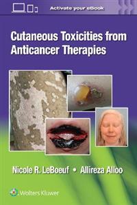 Cutaneous Toxicities from Anticancer Therapies - Click Image to Close