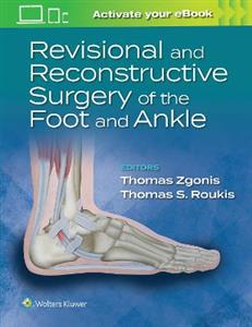Revisional and Reconstructive Surgery of the Foot and Ankle - Click Image to Close