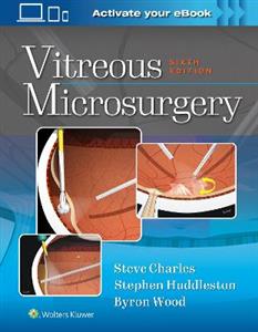 Vitreous Microsurgery