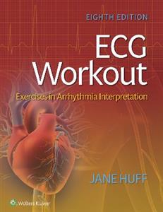 ECG Workout: Exercises in Arrhythmia Interpretation - Click Image to Close