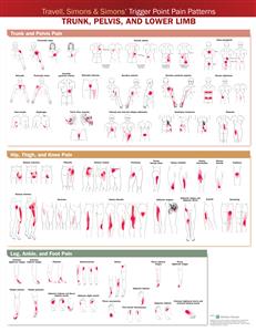 Travell, Simons amp; Simons? Trigger Point Pain Patterns Wall Chart