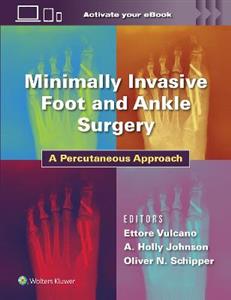 Minimally Invasive Foot and Ankle Surgery: A Percutaneous Approach - Click Image to Close