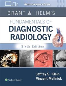 Brant & Helm's Fundamentals of Diagnostic Radiology: Print + eBook with Multimedia - Click Image to Close