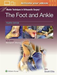 Master Techniques in Orthopaedic Surgery: The Foot and Ankle - Click Image to Close