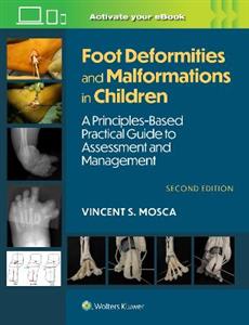 Foot Deformities and Malformations in Children: A Principles-Based, Practical Guide to Assessment and Management: Print + eBook with Multimedia - Click Image to Close