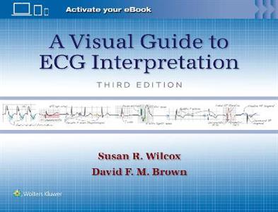 A Visual Guide to ECG Interpretation - Click Image to Close