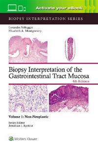 Biopsy Interpretation of the Gastrointestinal Tract Mucosa Volume 1: Non-Neoplastic: Print + eBook with Multimedia - Click Image to Close