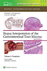 Biopsy Interpretation of the Gastrointestinal Tract Mucosa Volume 2: Neoplastic: Print + eBook with Multimedia - Click Image to Close