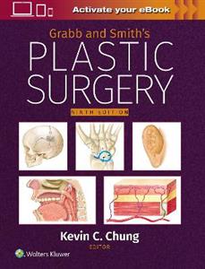 Grabb and Smith's Plastic Surgery: Print + eBook with Multimedia - Click Image to Close