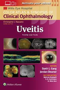 Uveitis - Click Image to Close