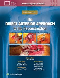 The Direct Anterior Approach to Hip Reconstruction - Click Image to Close