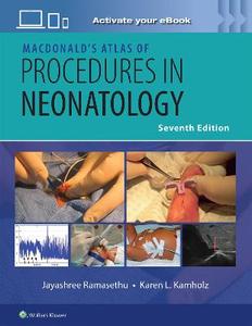 MacDonald's Atlas of Procedures in Neonatology Print + eBook with Multimedia