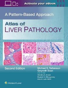 Atlas of Liver Pathology: A Pattern-Based Approach