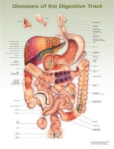 Diseases of the Digestive Tract Anatomical Chart - Click Image to Close