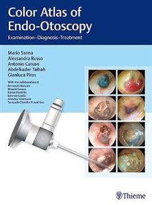 Color Atlas of Endo-Otoscopy: Examination-Diagnosis-Treatment - Click Image to Close