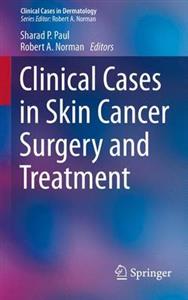 Clinical Cases in Skin Cancer Surgery and Treatment - Click Image to Close
